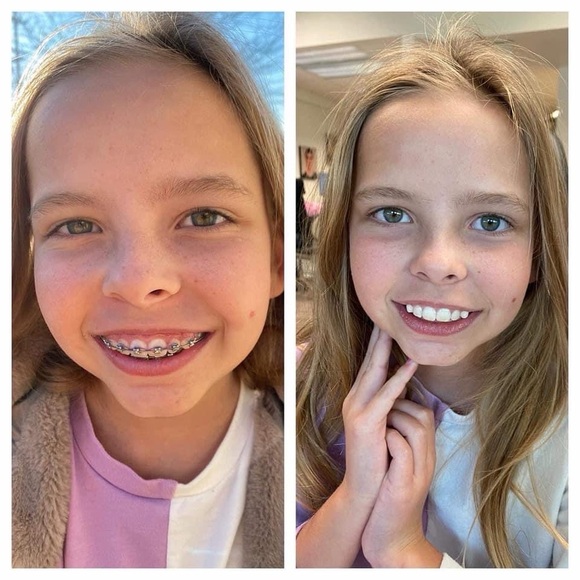 AP24 whitening toothpaste - Picture 6 of 7